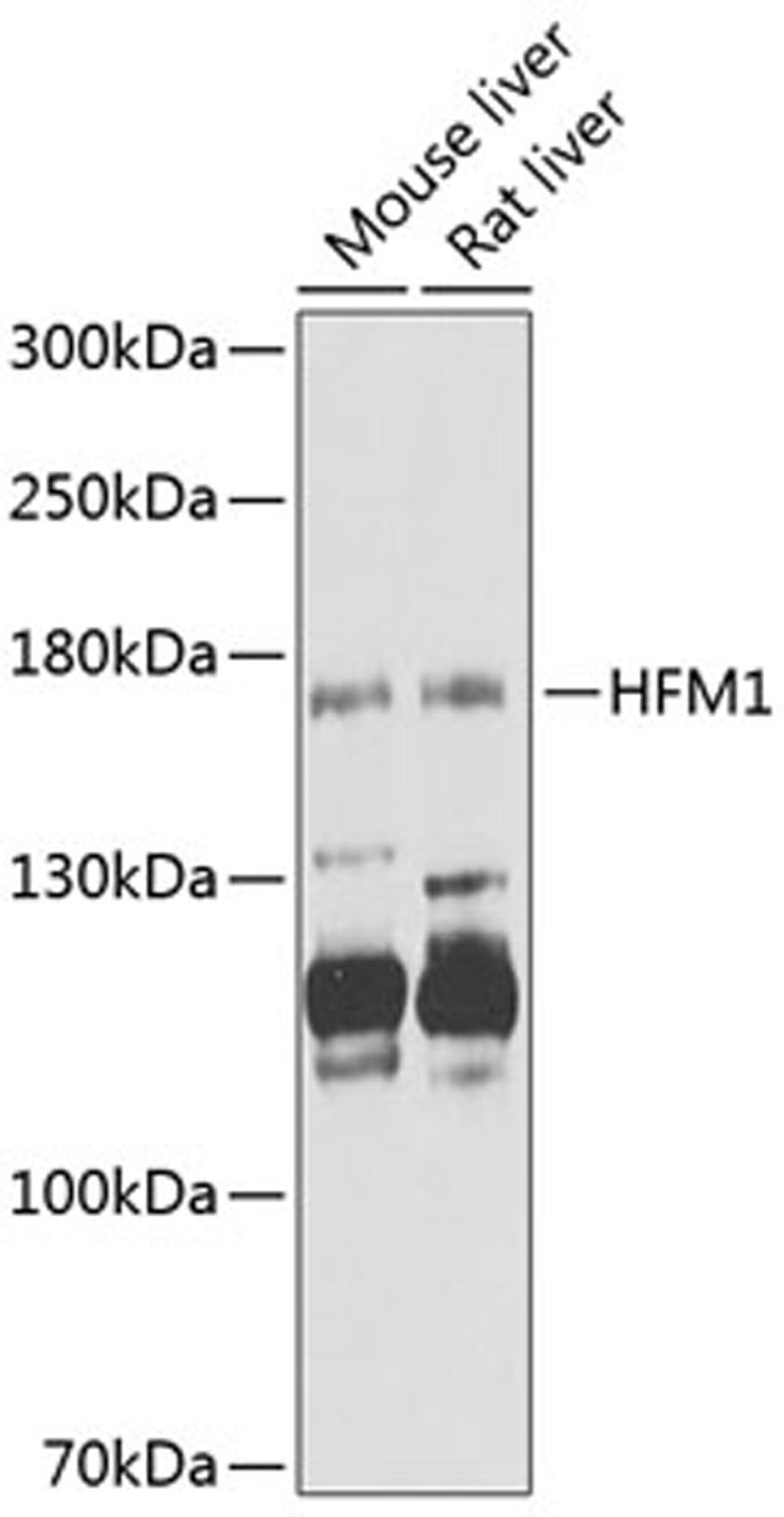 Western blot - HFM1 antibody (A12614)