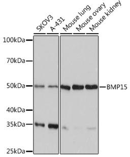 Western blot - BMP15 Rabbit mAb (A4148)