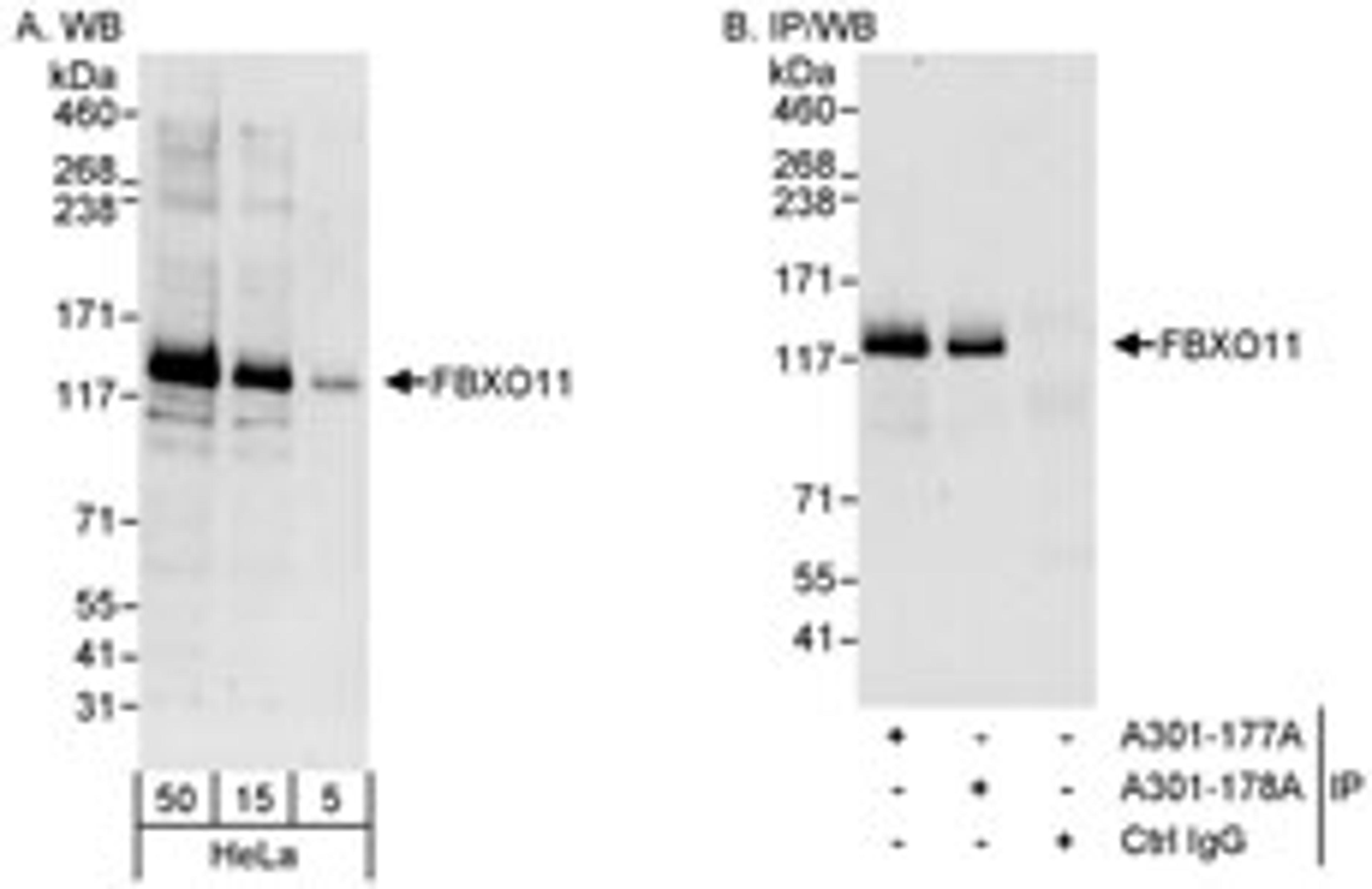 Detection of human FBXO11 by western blot and immunoprecipitation.