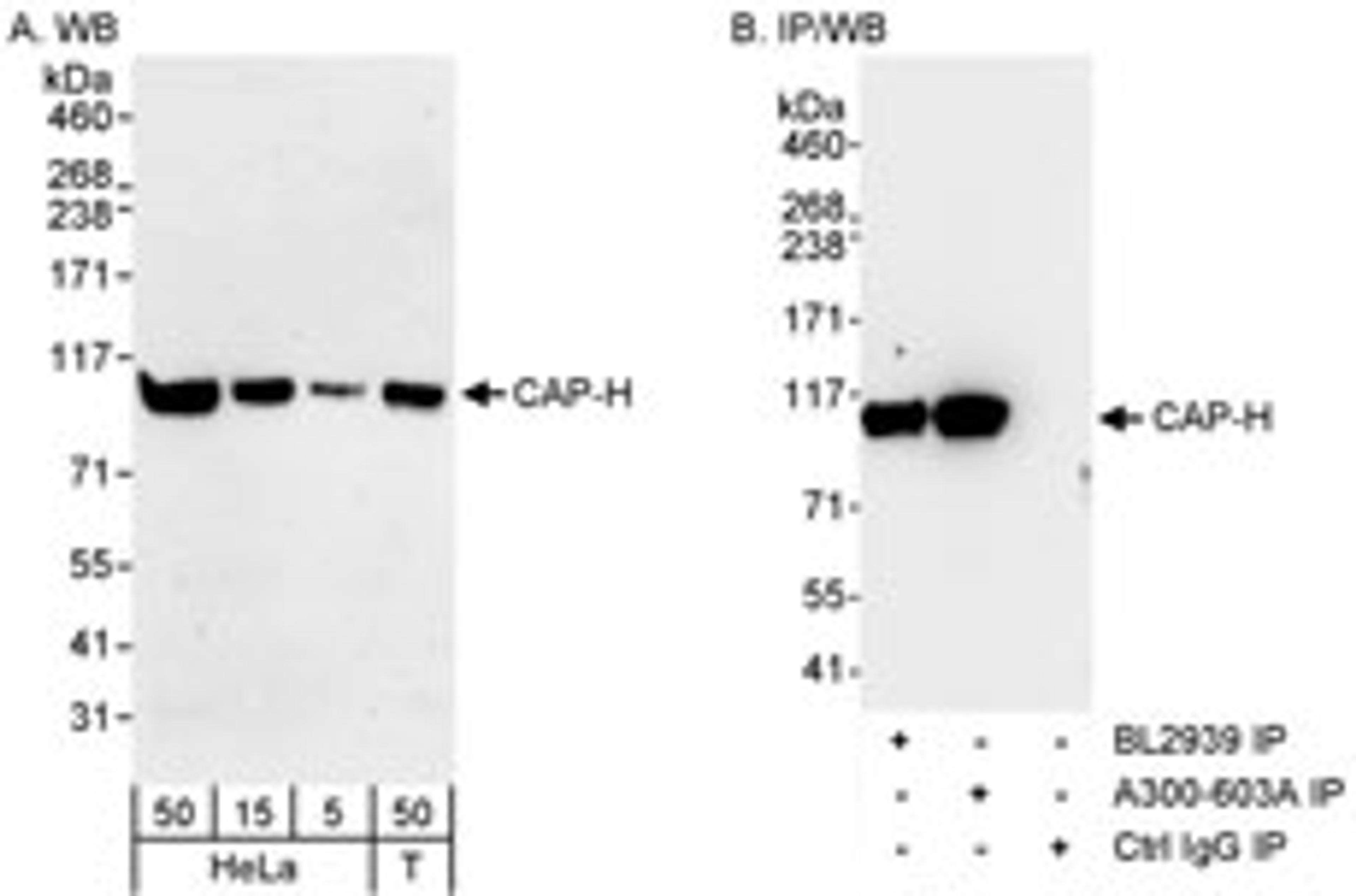 Detection of human CAP-H by western blot and immunoprecipitation.