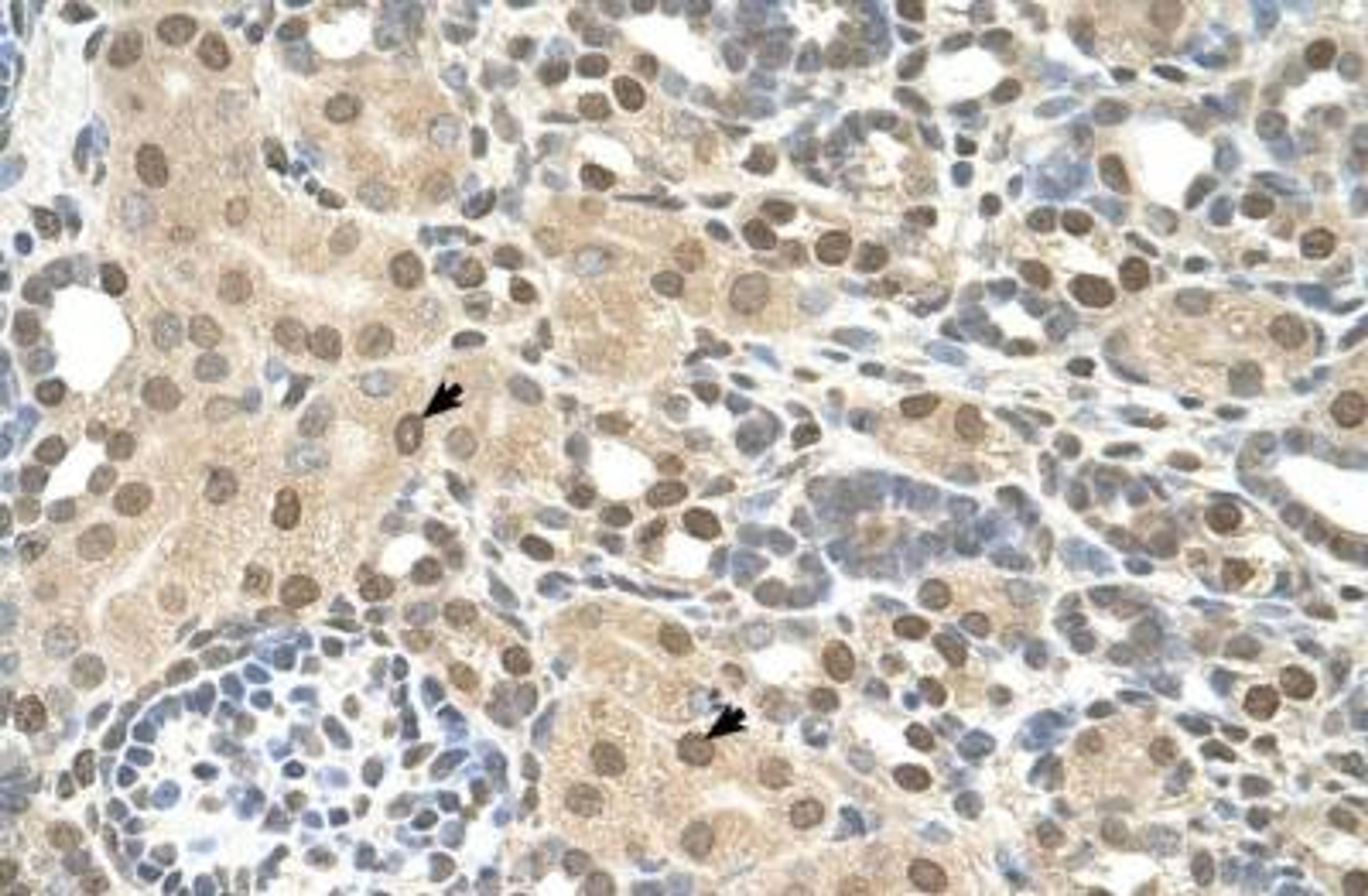 Immunohistochemistry-Paraffin: TMEM30A Antibody [NBP1-59474] - Embedded Tissue: Human Kidney Cellular Data: Epithelial cells of renal.