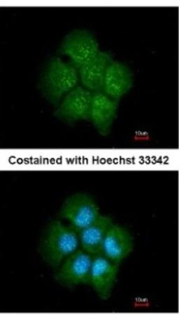 Immunocytochemistry/Immunofluorescence: Tankyrase binding protein 1 Antibody [NBP2-20561] - Analysis of methanol-fixed A431, using antibody at 1:200 dilution.