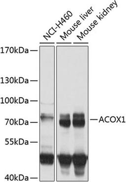 Western blot - ACOX1 antibody (A8091)