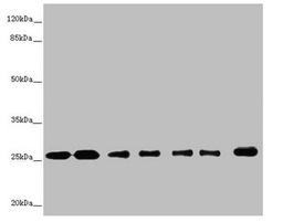 Western blot. All lanes: RALB antibody at 1.26µg/ml. Lane 1: Mouse brain tissue. Lane 2: Mouse lung tissue. Lane 3: MCF-7 whole cell lysate. Lane 4: HepG2 whole cell lysate. Lane 5: Jurkat whole cell lysate. Lane 6: NIH/3T3 whole cell lysate. Lane 7: Hela whole cell lysate. Secondary. Goat polyclonal to rabbit IgG at 1/10000 dilution. Predicted band size: 24, 26 kDa. Observed band size: 26 kDa