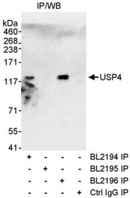 Detection of human USP4 by western blot of immunoprecipitates.