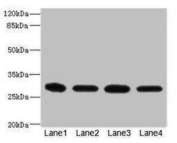 Western blot. All lanes: EIF3K antibody at 1.72µg/ml. Lane 1: THP-1 whole cell lysate. Lane 2: HT29 whole cell lysate. Lane 3: 293T whole cell lysate. Lane 4: Hela whole cell lysate. Secondary. Goat polyclonal to rabbit IgG at 1/10000 dilution. Predicted band size: 26, 25 kDa. Observed band size: 26 kDa