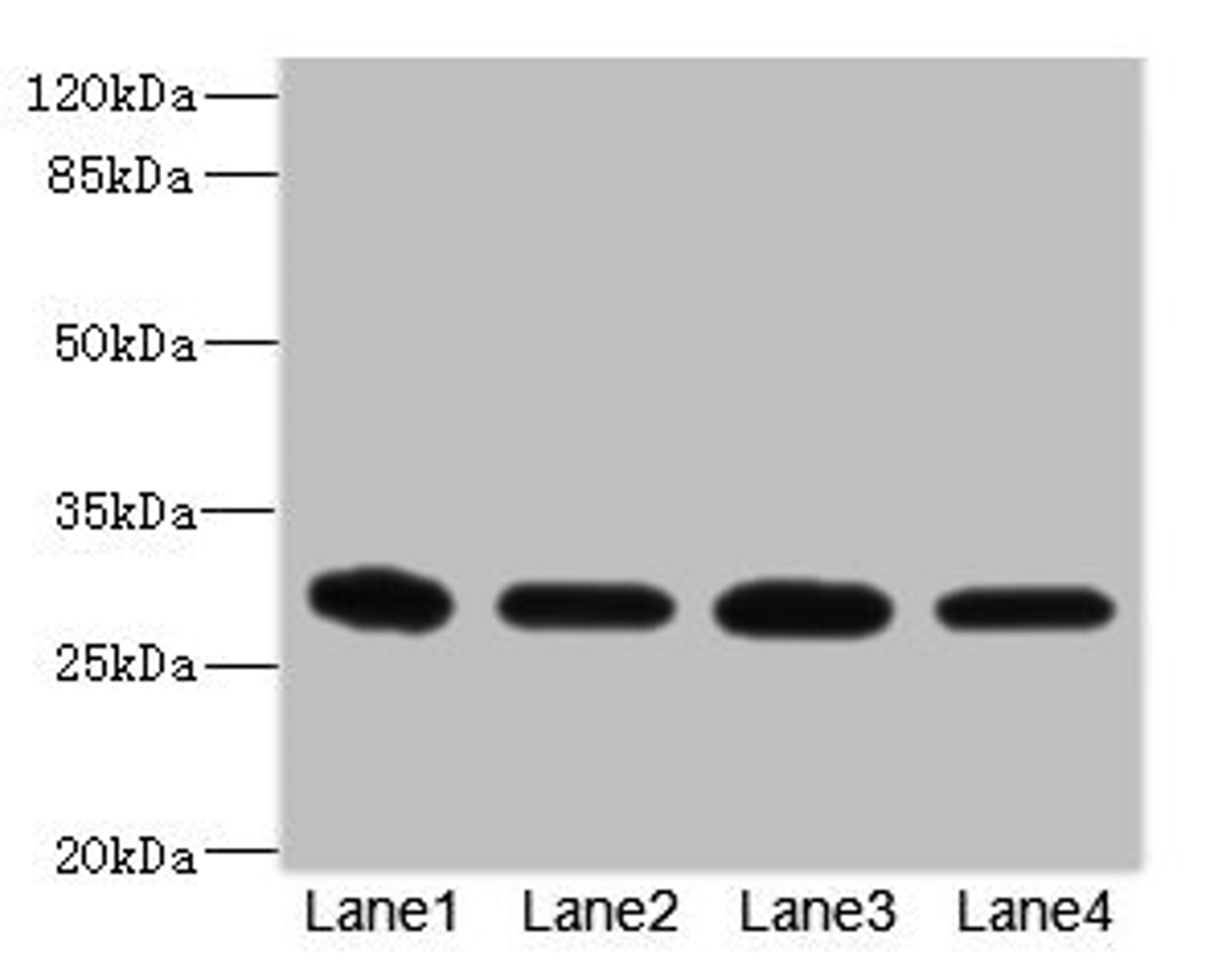 Western blot. All lanes: EIF3K antibody at 1.72µg/ml. Lane 1: THP-1 whole cell lysate. Lane 2: HT29 whole cell lysate. Lane 3: 293T whole cell lysate. Lane 4: Hela whole cell lysate. Secondary. Goat polyclonal to rabbit IgG at 1/10000 dilution. Predicted band size: 26, 25 kDa. Observed band size: 26 kDa