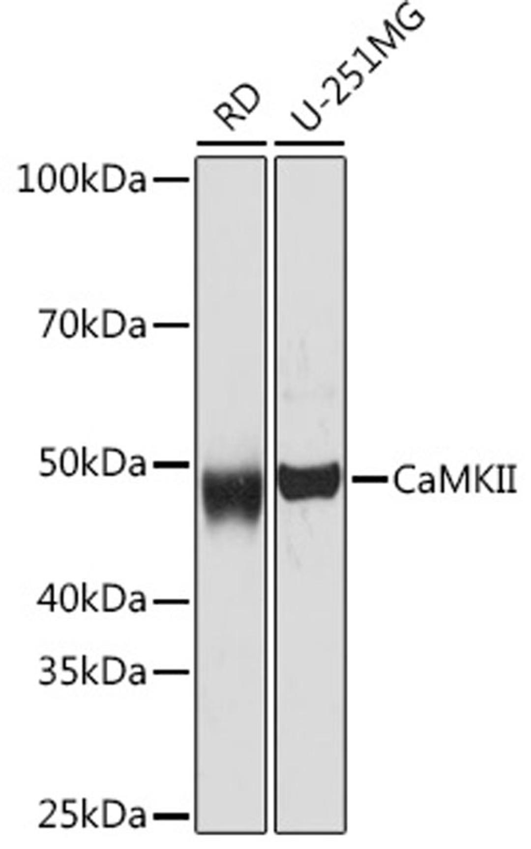 Western blot - CaMKII Rabbit mAb (A0186)