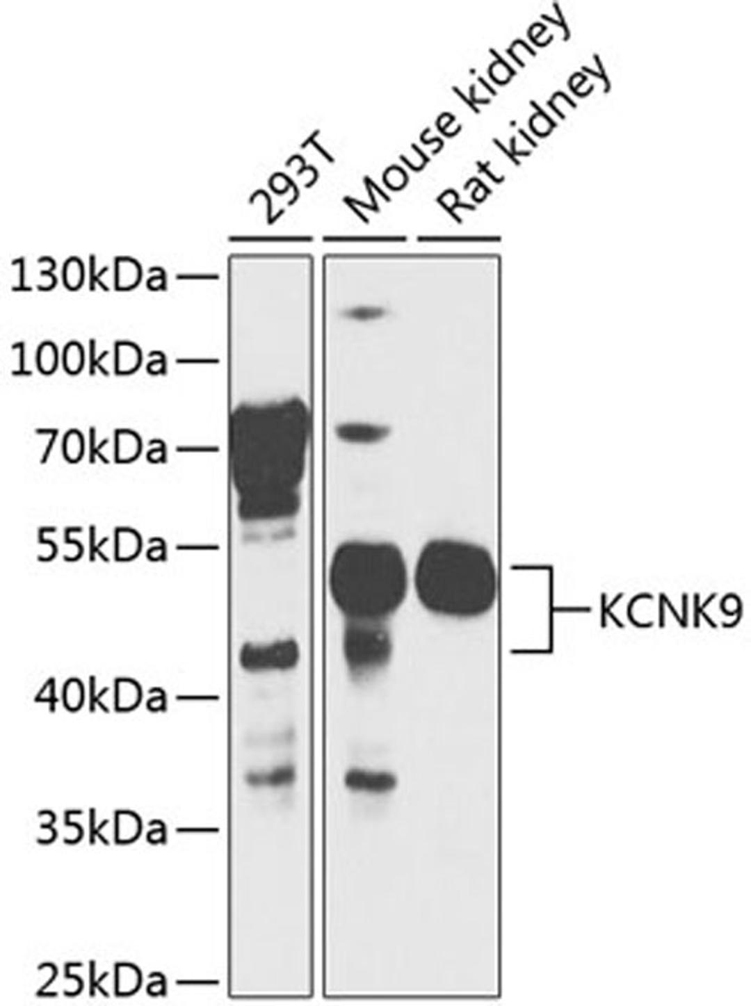 Western blot - KCNK9 antibody (A8609)