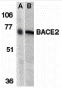 Western blot analysis of BACE2 in (A) human and (B) mouse heart tissue lysates with BACE2 antibody at 1 &#956;g/mL. 