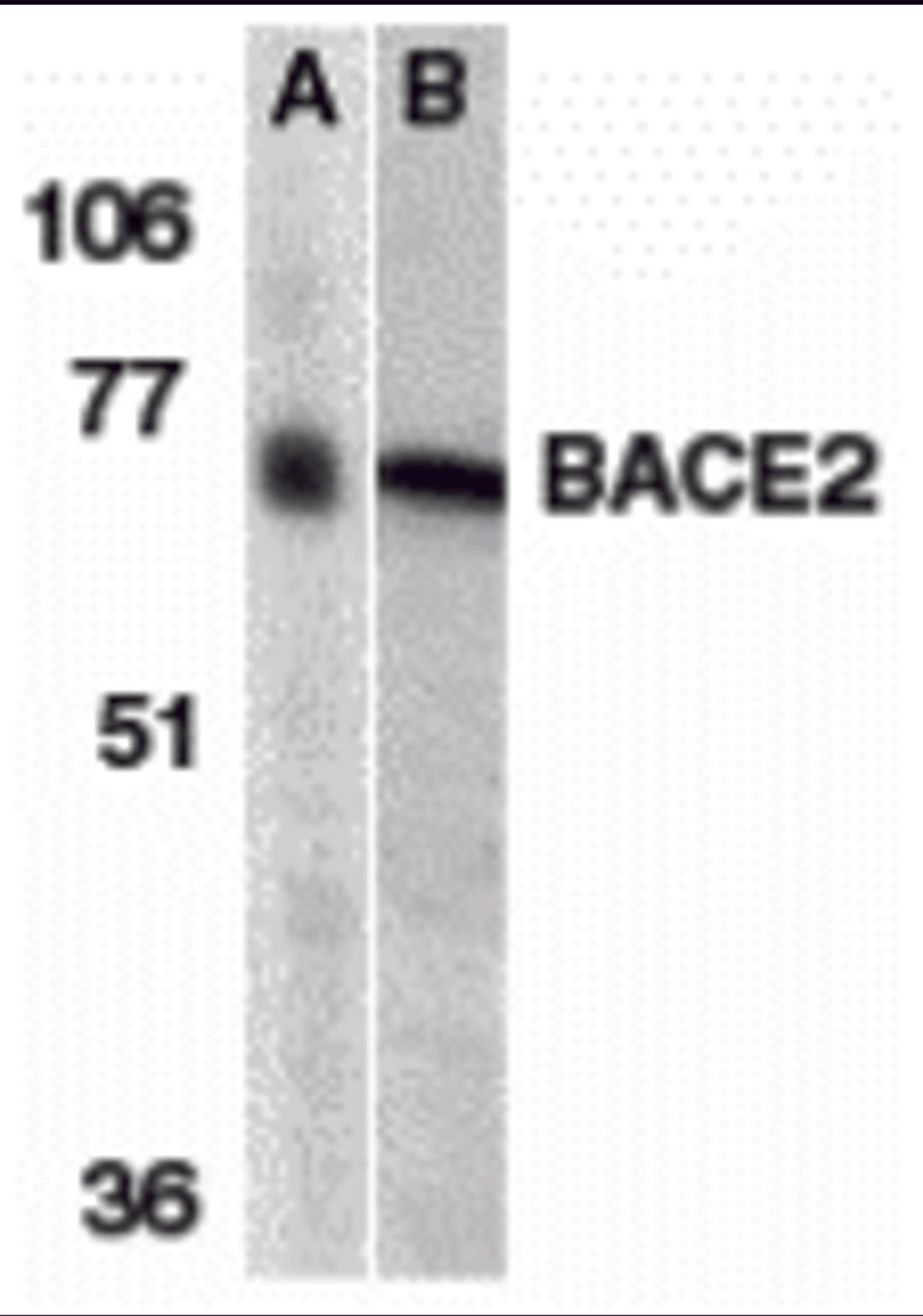 Western blot analysis of BACE2 in (A) human and (B) mouse heart tissue lysates with BACE2 antibody at 1 μg/mL.