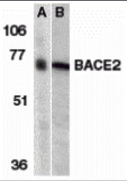 Western blot analysis of BACE2 in (A) human and (B) mouse heart tissue lysates with BACE2 antibody at 1 μg/mL.
