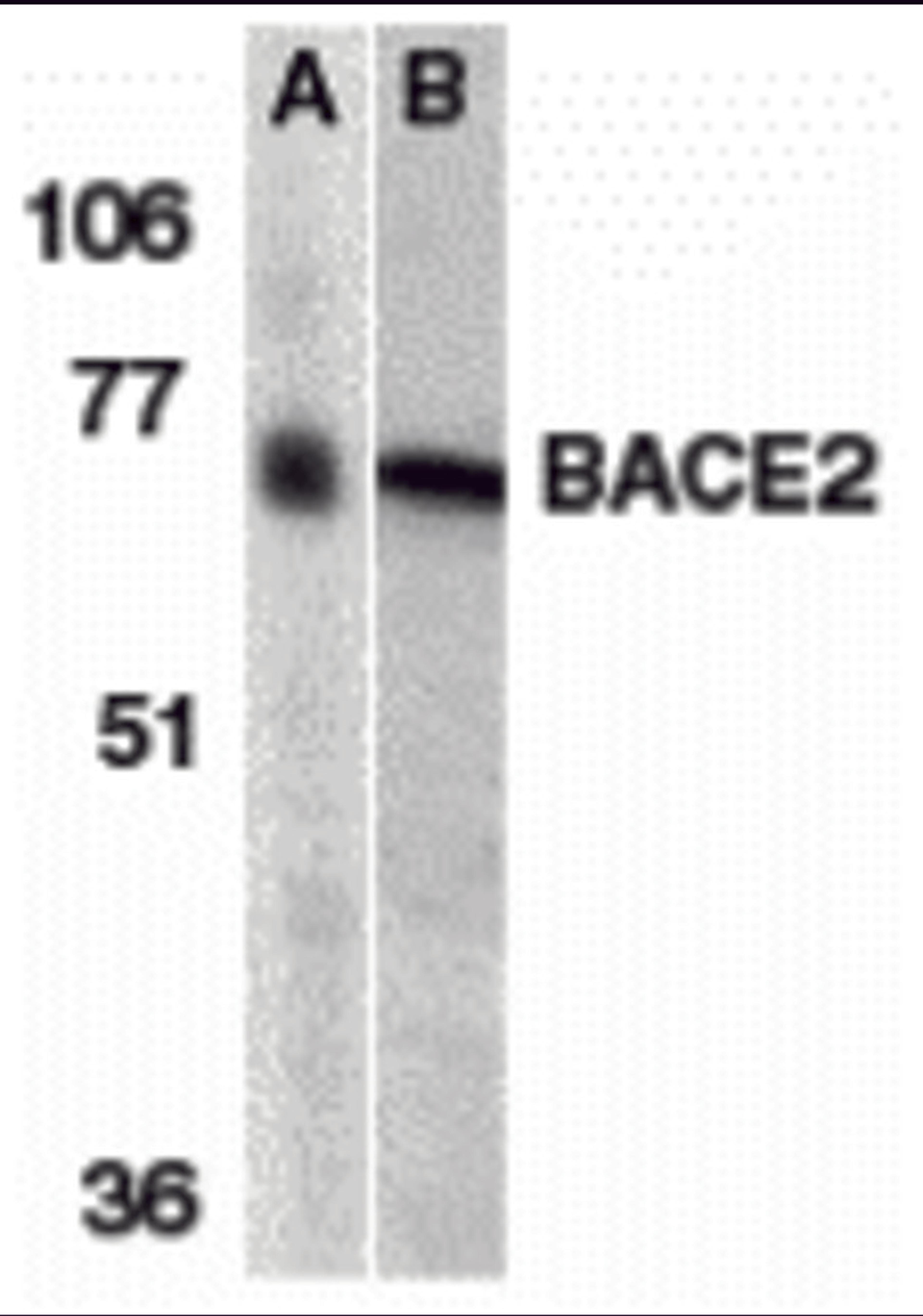 Western blot analysis of BACE2 in (A) human and (B) mouse heart tissue lysates with BACE2 antibody at 1 μg/mL.
