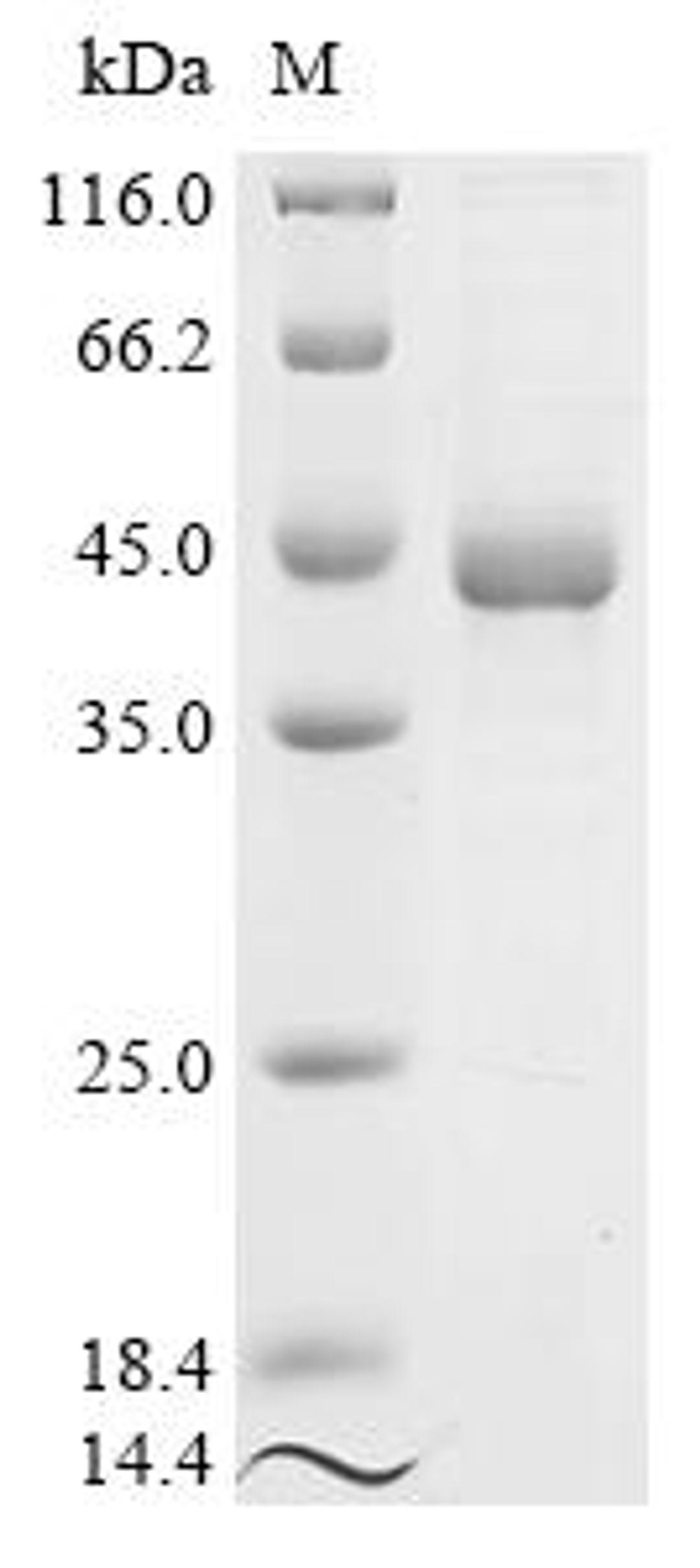 (Tris-Glycine gel) Discontinuous SDS-PAGE (reduced) with 5% enrichment gel and 15% separation gel.