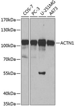 Western blot - ACTN1 antibody (A1160)