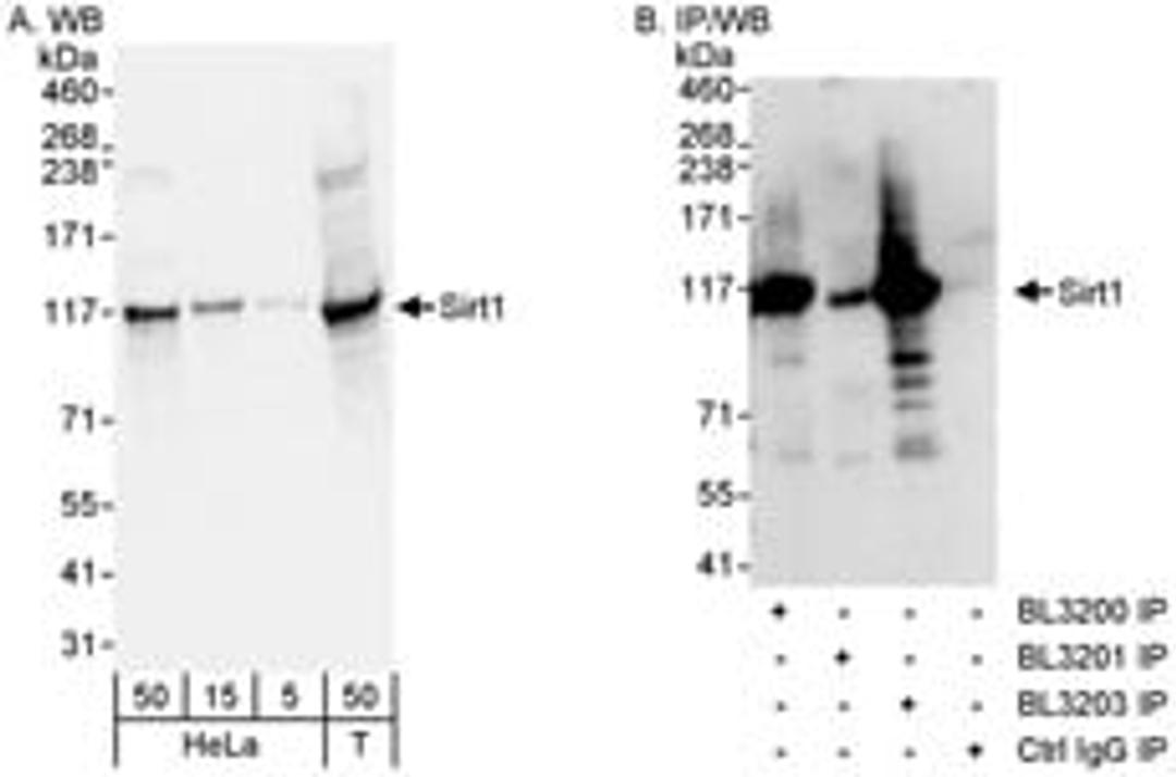 Detection of human Sirt1 by western blot and immunoprecipitation. expndtw-6