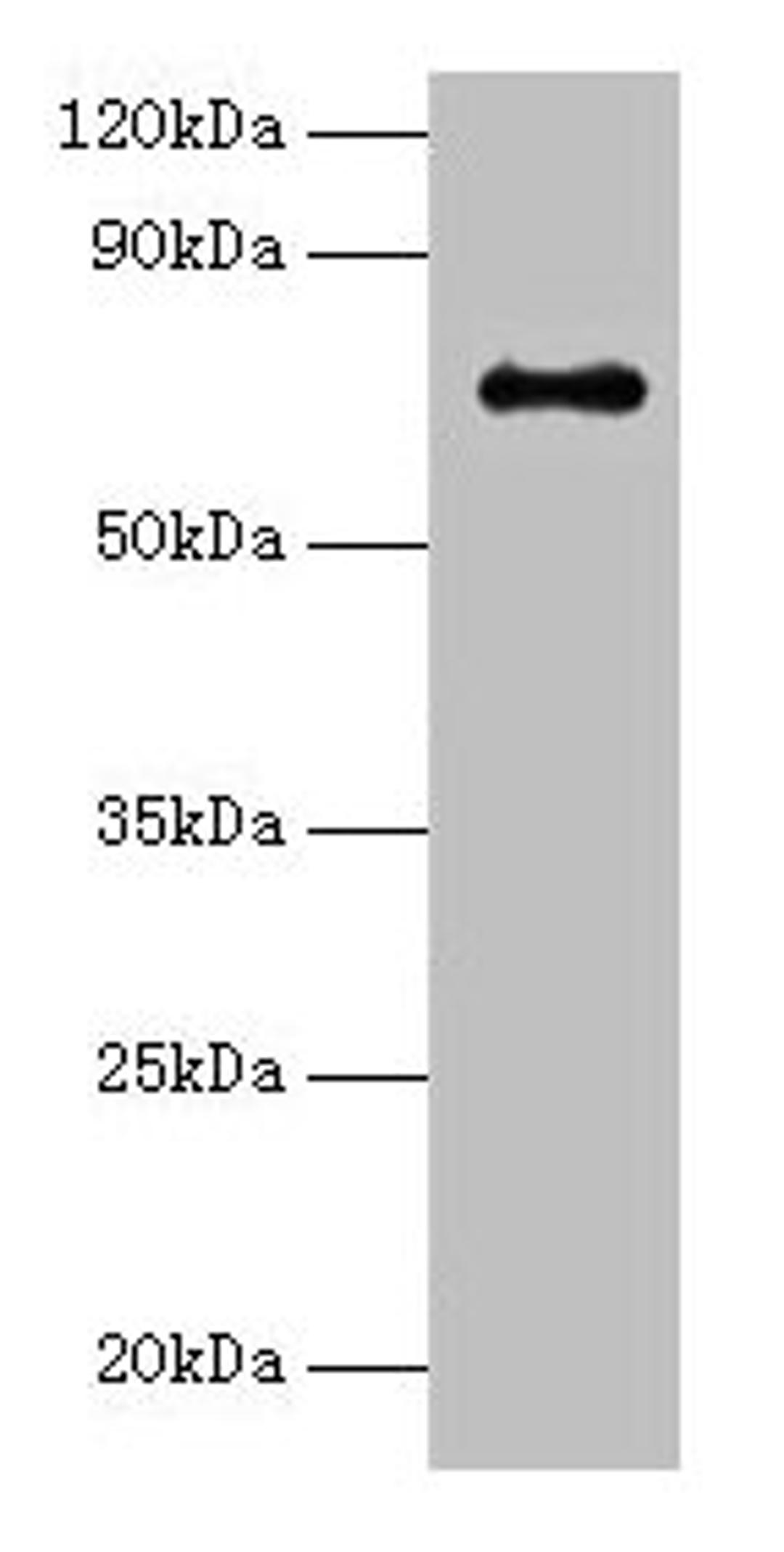 Western blot. All lanes: Adck2 antibody at 2µg/ml + K562 whole cell lysate. Secondary. Goat polyclonal to rabbit IgG at 1/15000 dilution. Predicted band size: 69 kDa. Observed band size: 69 kDa