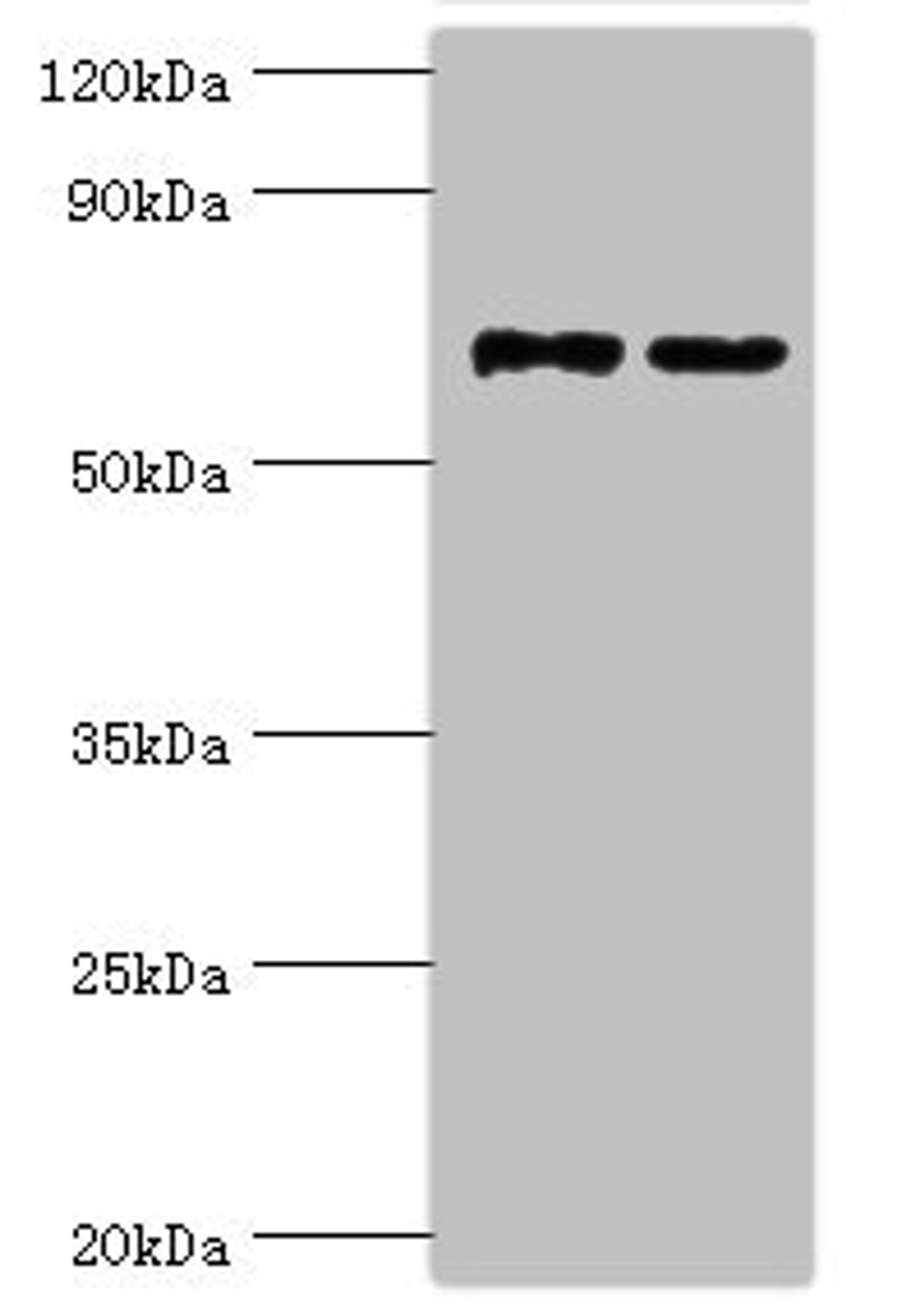 Western blot. All lanes: Myotubularin-related protein 14 antibody at 10ug/ml. Lane 1: Hela whole cell lysate. Lane 2: Mouse skeletal muscle tissue. Secondary. Goat polyclonal to rabbit IgG at 1/10000 dilution. Predicted band size: 73, 67, 61 kDa. Observed band size: 73 kDa.