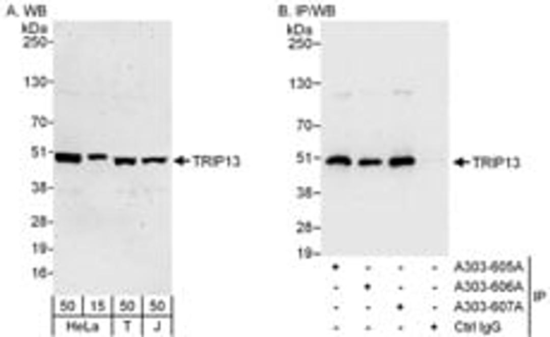 Detection of human TRIP13 by western blot and immunoprecipitation.