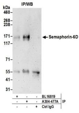 Detection of human Semaphorin-6D by western blot of immunoprecipitates.