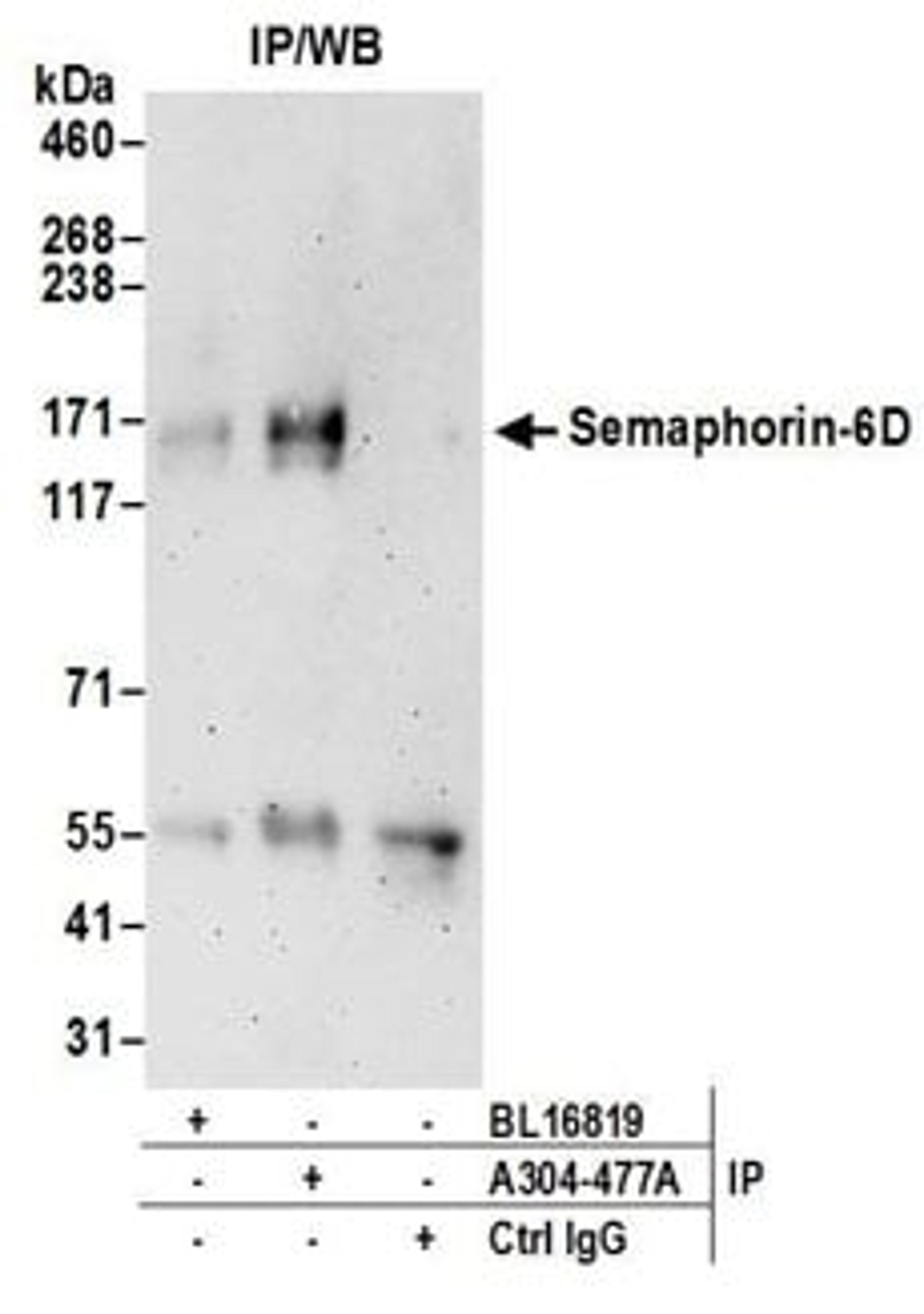 Detection of human Semaphorin-6D by western blot of immunoprecipitates.