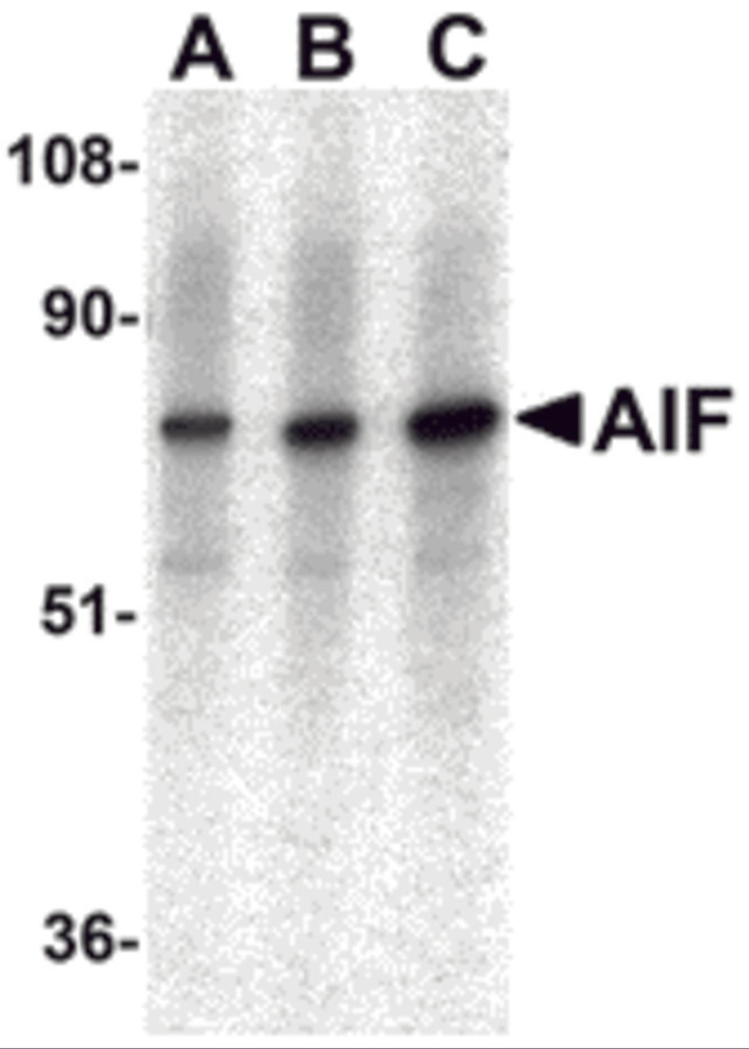 Western blot analysis of AIF in K562 with AIF antibody at (A) 0.5, (B) 1, and (C) 2 μg/mL.