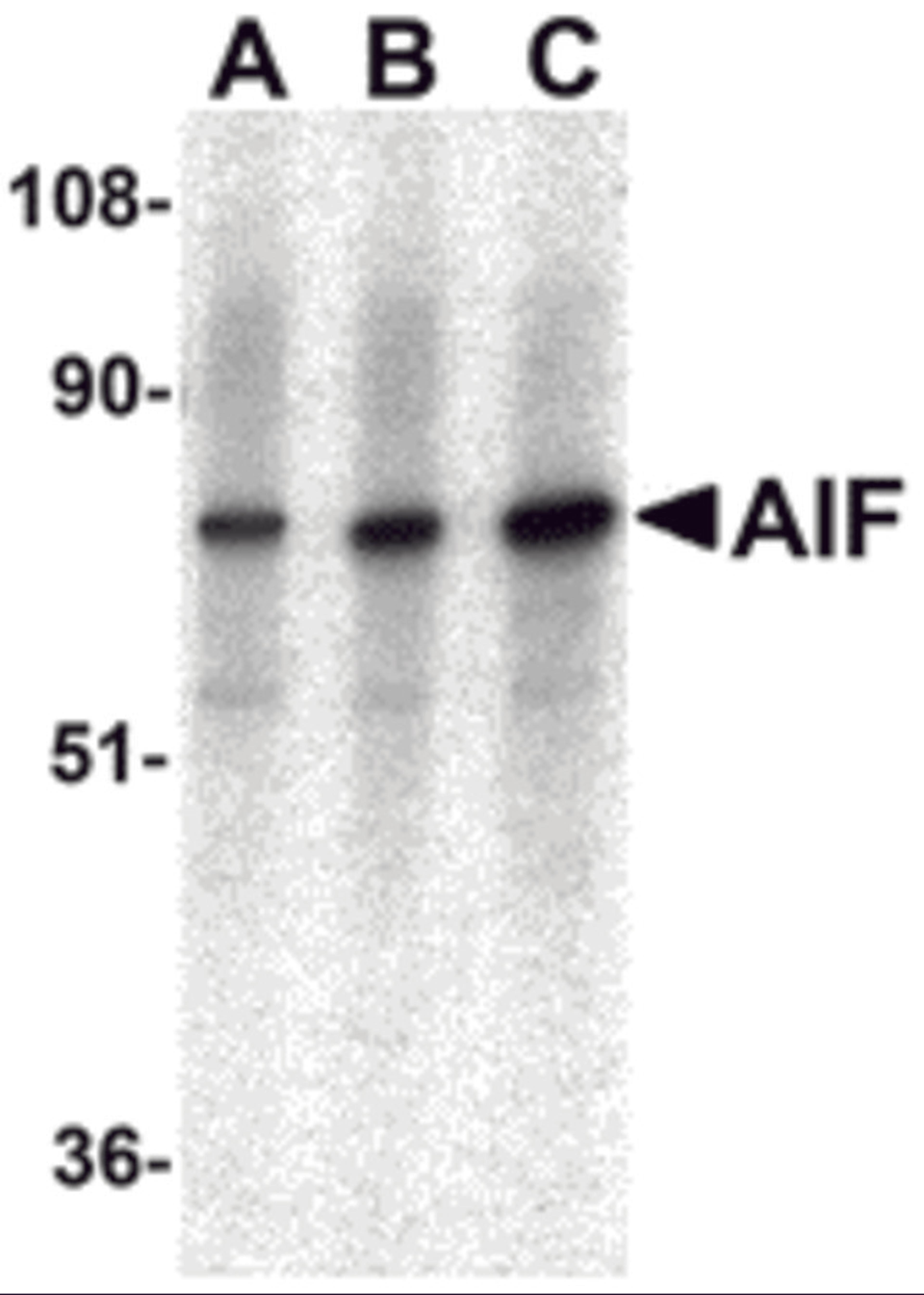 Western blot analysis of AIF in K562 with AIF antibody at (A) 0.5, (B) 1, and (C) 2 μg/mL.