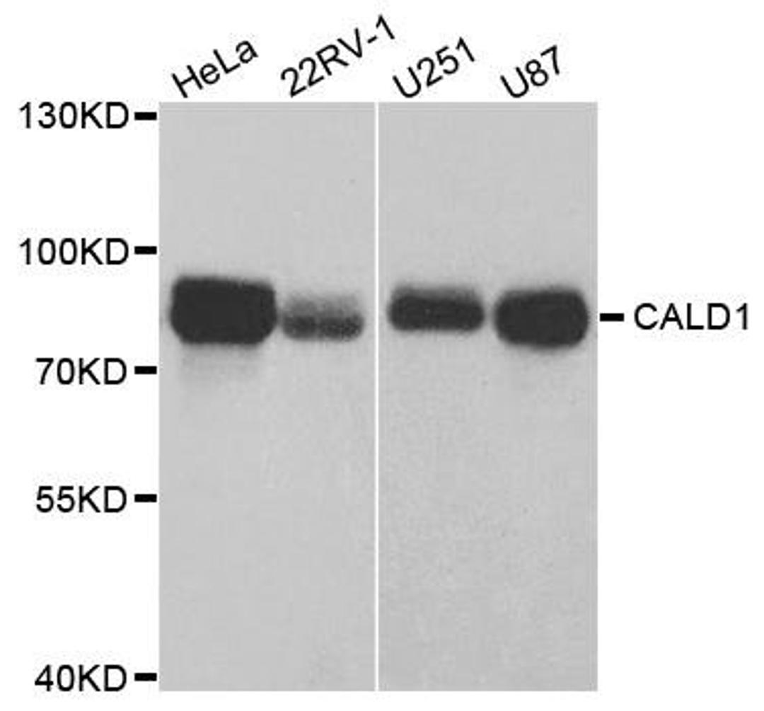 Western blot analysis of extracts of various cell lines using CALD1 antibody