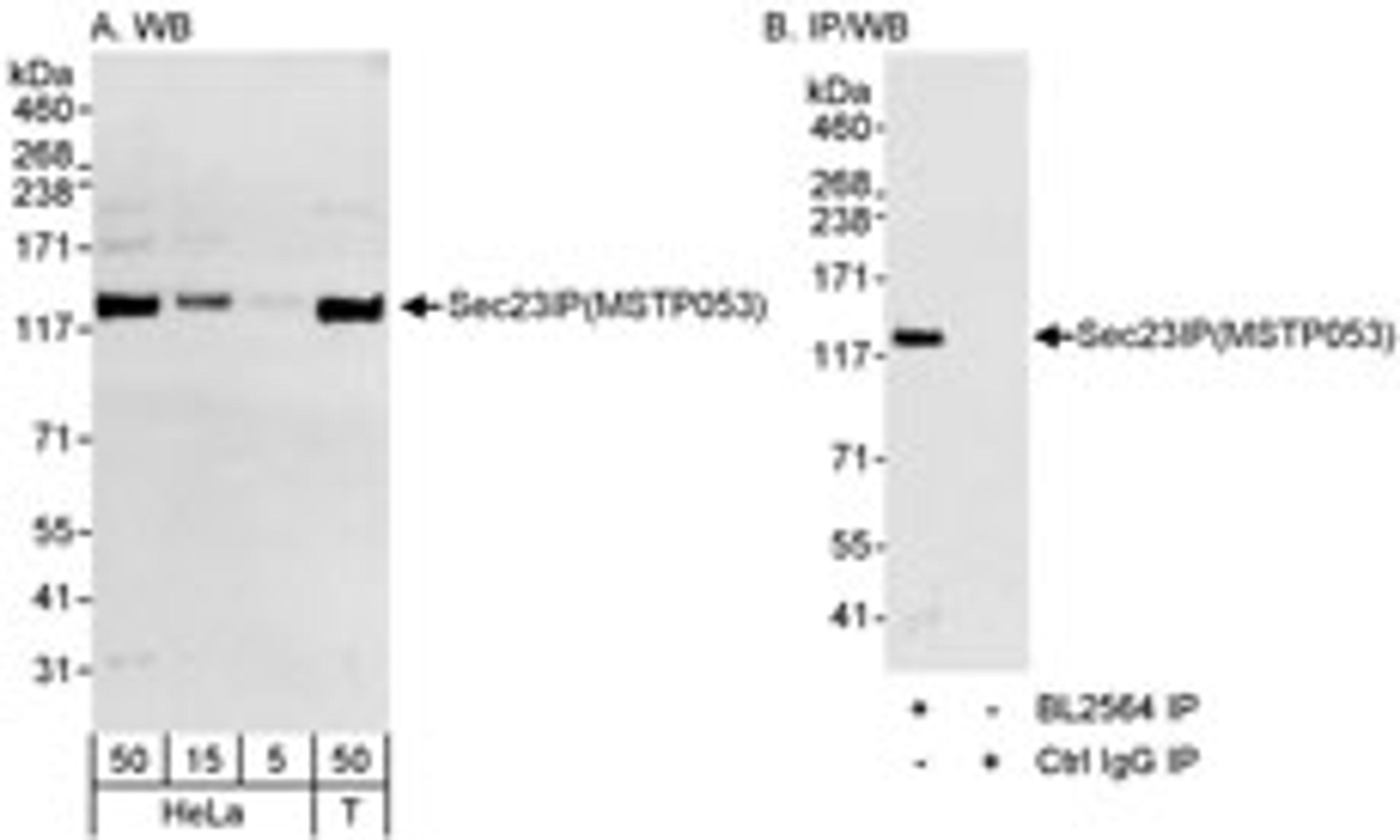 Detection of human Sec23IP(MSTP053) by western blot and immunoprecipitation.