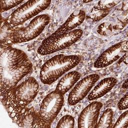 Immunohistochemistry: gamma Adducin Antibody [NBP2-34017] - Staining of human stomach, lower shows strong cytoplasmic and membranous positivity in glandular cells.