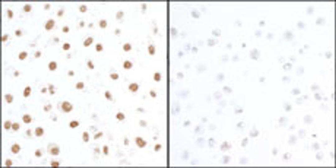 Detection of human Phospho KAP-1 (S824) by immunocytochemistry.