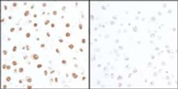 Detection of human Phospho KAP-1 (S824) by immunocytochemistry.