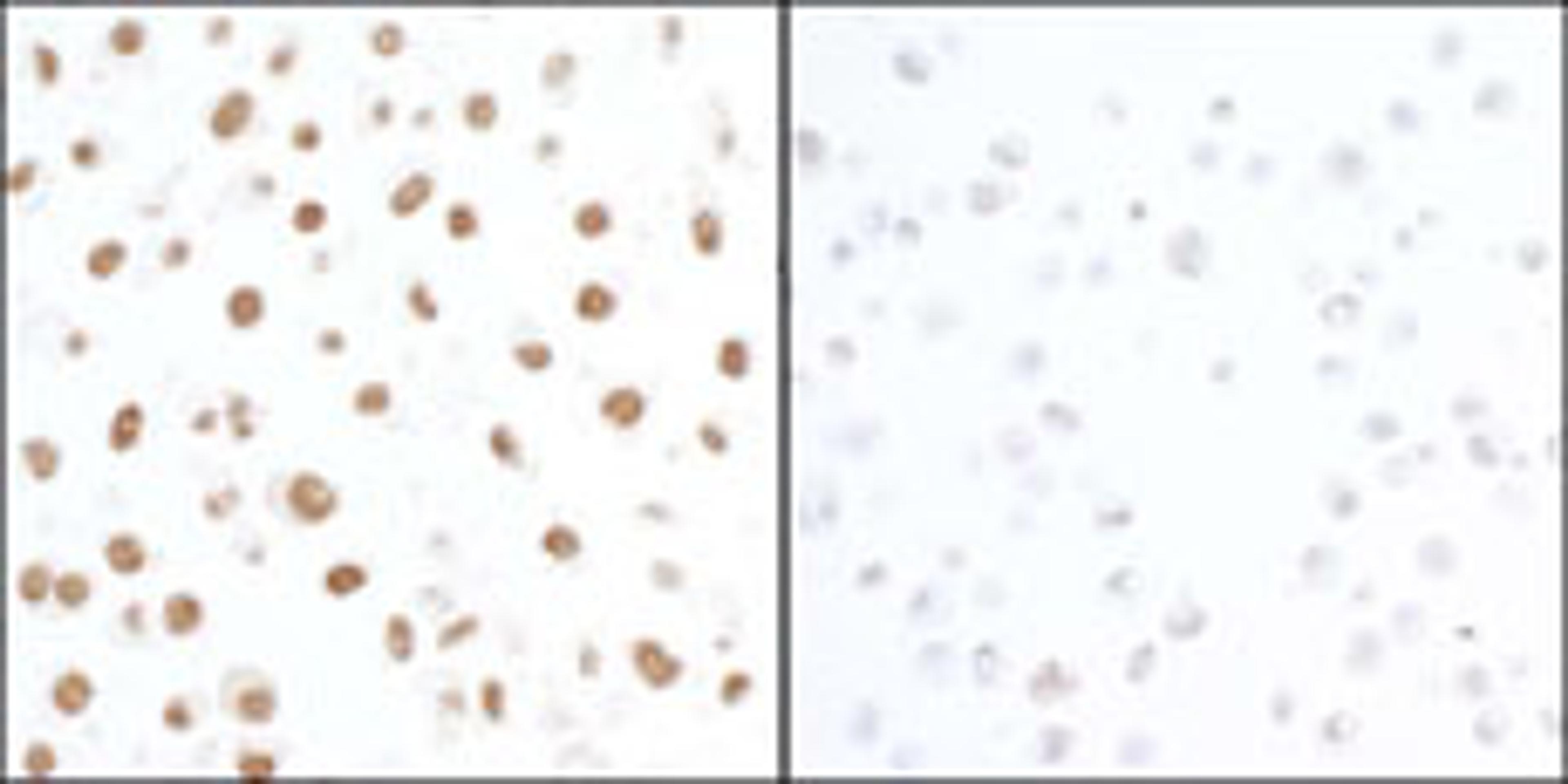 Detection of human Phospho KAP-1 (S824) by immunocytochemistry.