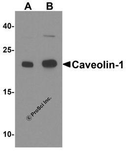 Western blot analysis of Caveolin-1 in human lung tissue lysate with Caveolin-1 antibody at (A) 1 and (B) 2 μg/mL.