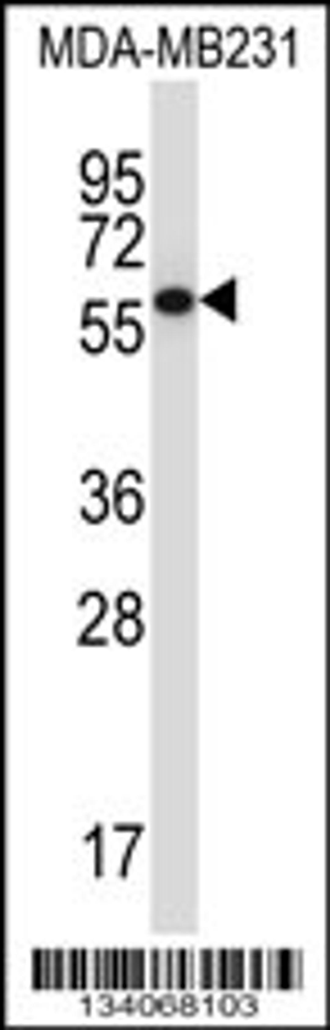 Western blot analysis in MDA-MB231 cell line lysates (35ug/lane).