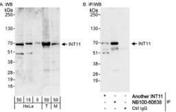 Western Blot: INTS11 Antibody [NB100-60638] - Whole cell lysate from HeLa (5, 15 and 50 ug for WB; 1 mg for IP, 20% of IP loaded), 293T (T; 50 ug) and mouse NIH3T3 (M; 50 ug) cells. NB100-60638 used for WB at 0.1 ug/ml (A) and 1 ug/ml (B) and used for IP at 3 ug/mg lysate.