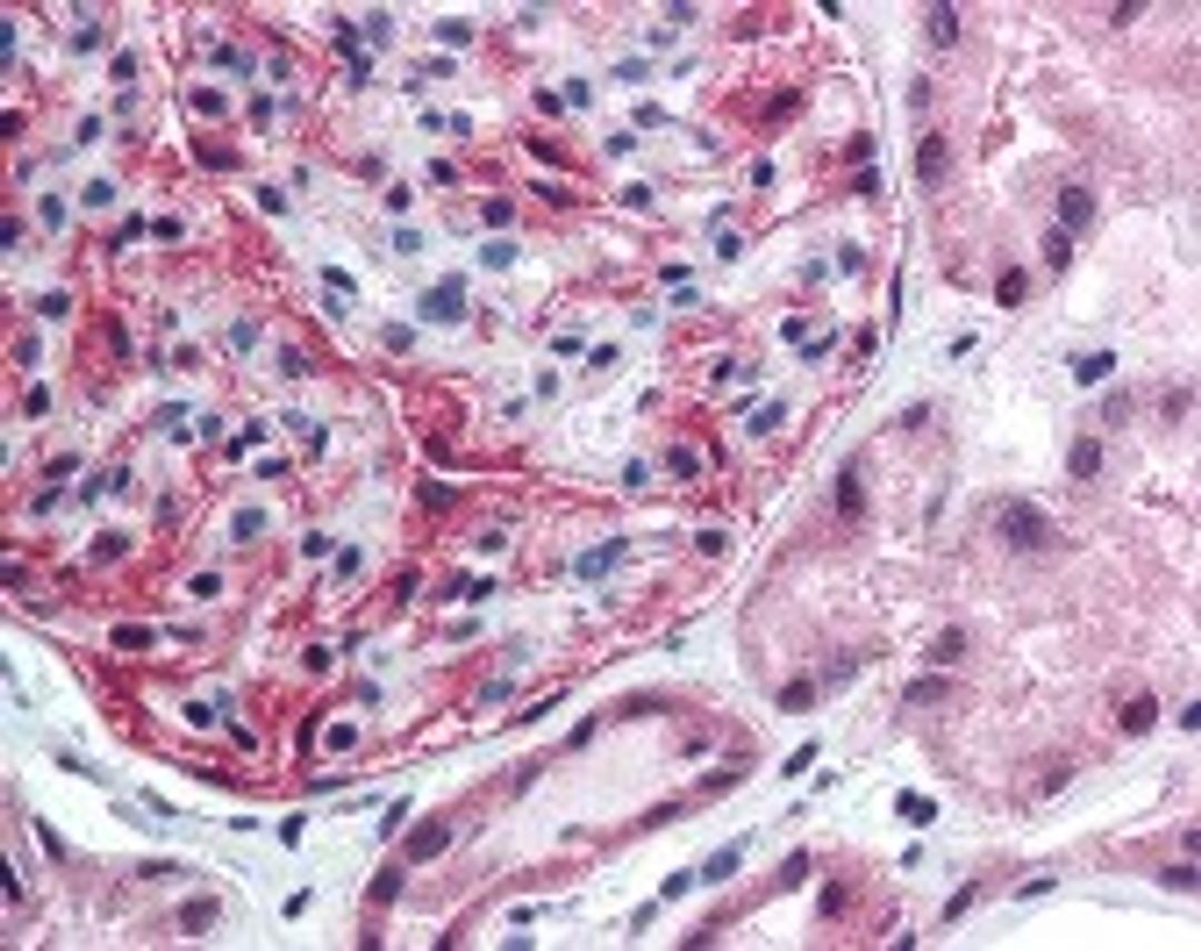 Immunohistochemistry staining of FANCF in kidney tissue using FANCF Antibody.