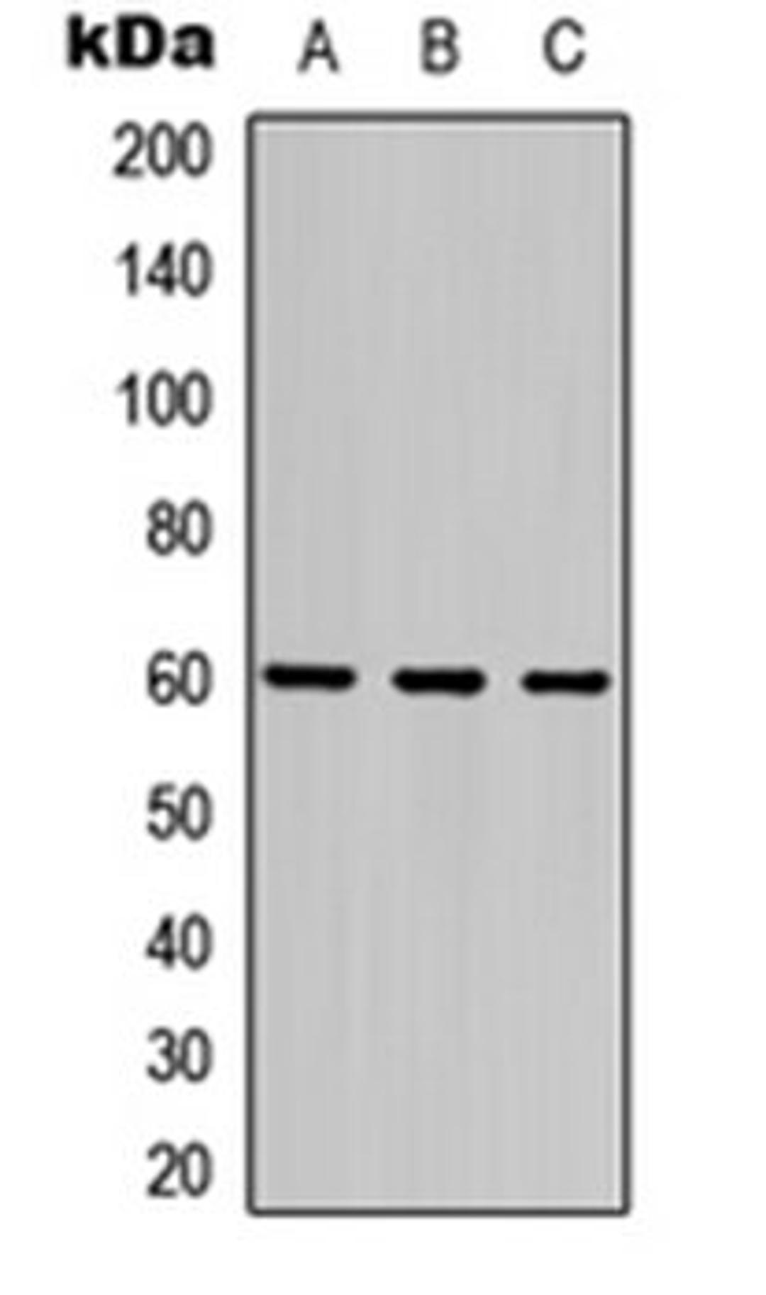 Western blot analysis of HEK293T (Lane 1), Raw264.7 (Lane 2), PC12 (Lane 3) whole cell lysates using Frizzled 4 antibody