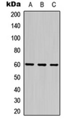 Western blot analysis of HEK293T (Lane 1), Raw264.7 (Lane 2), PC12 (Lane 3) whole cell lysates using Frizzled 4 antibody