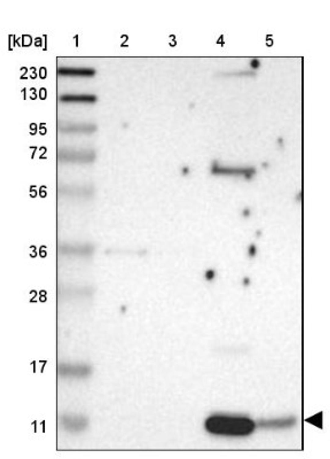 Western Blot: NAP2 Antibody [NBP1-89921] - Lane 1: Marker [kDa] 230, 130, 95, 72, 56, 36, 28, 17, 11<br/>Lane 2: Human cell line RT-4<br/>Lane 3: Human cell line U-251MG sp<br/>Lane 4: Human plasma (IgG/HSA depleted)<br/>Lane 5: Human liver tissue