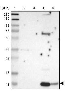 Western Blot: NAP2 Antibody [NBP1-89921] - Lane 1: Marker [kDa] 230, 130, 95, 72, 56, 36, 28, 17, 11<br/>Lane 2: Human cell line RT-4<br/>Lane 3: Human cell line U-251MG sp<br/>Lane 4: Human plasma (IgG/HSA depleted)<br/>Lane 5: Human liver tissue