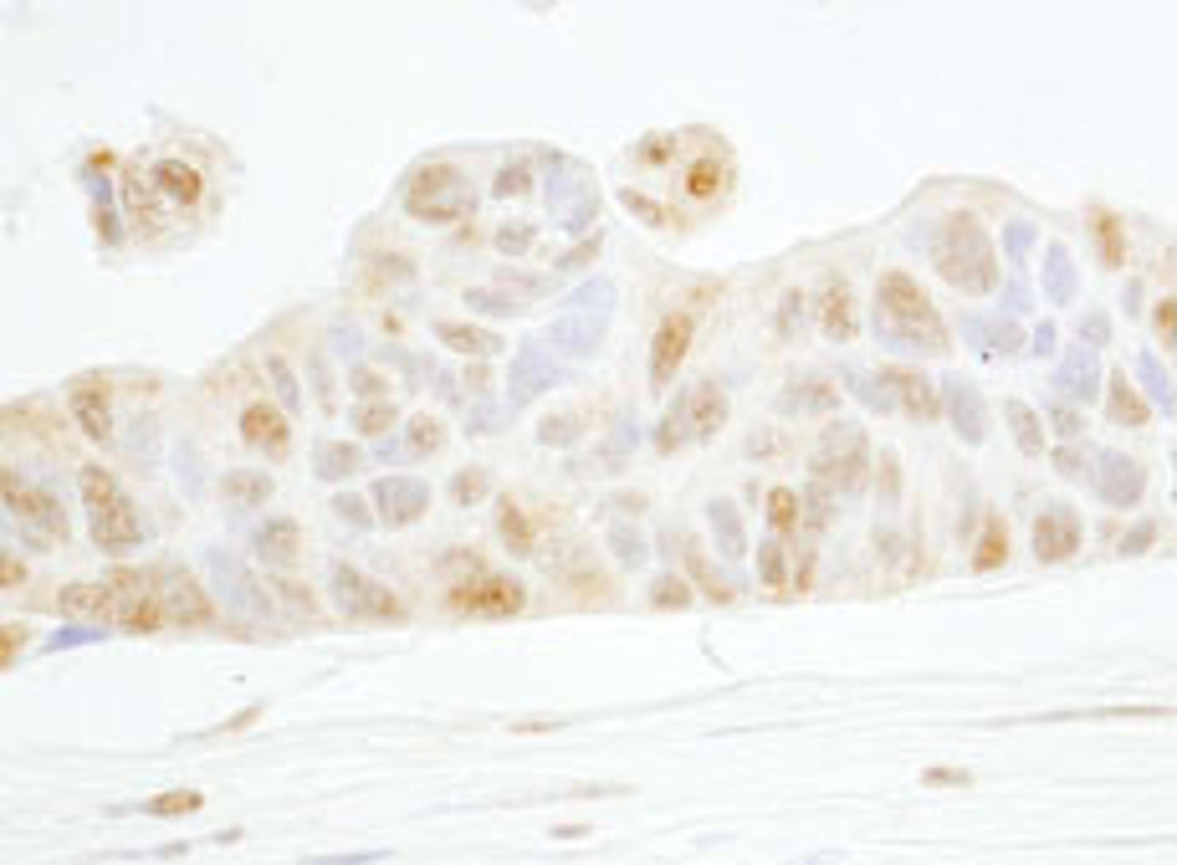 Detection of human Cyclin E1 by immunohistochemistry.