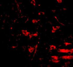 Immunocytochemistry/Immunofluorescence: RCAN2 Antibody [NBP1-76995] - Immunofluorescence of RCAN2 in mouse brain tissue with RCAN2 antibody at 20 ug/mL.