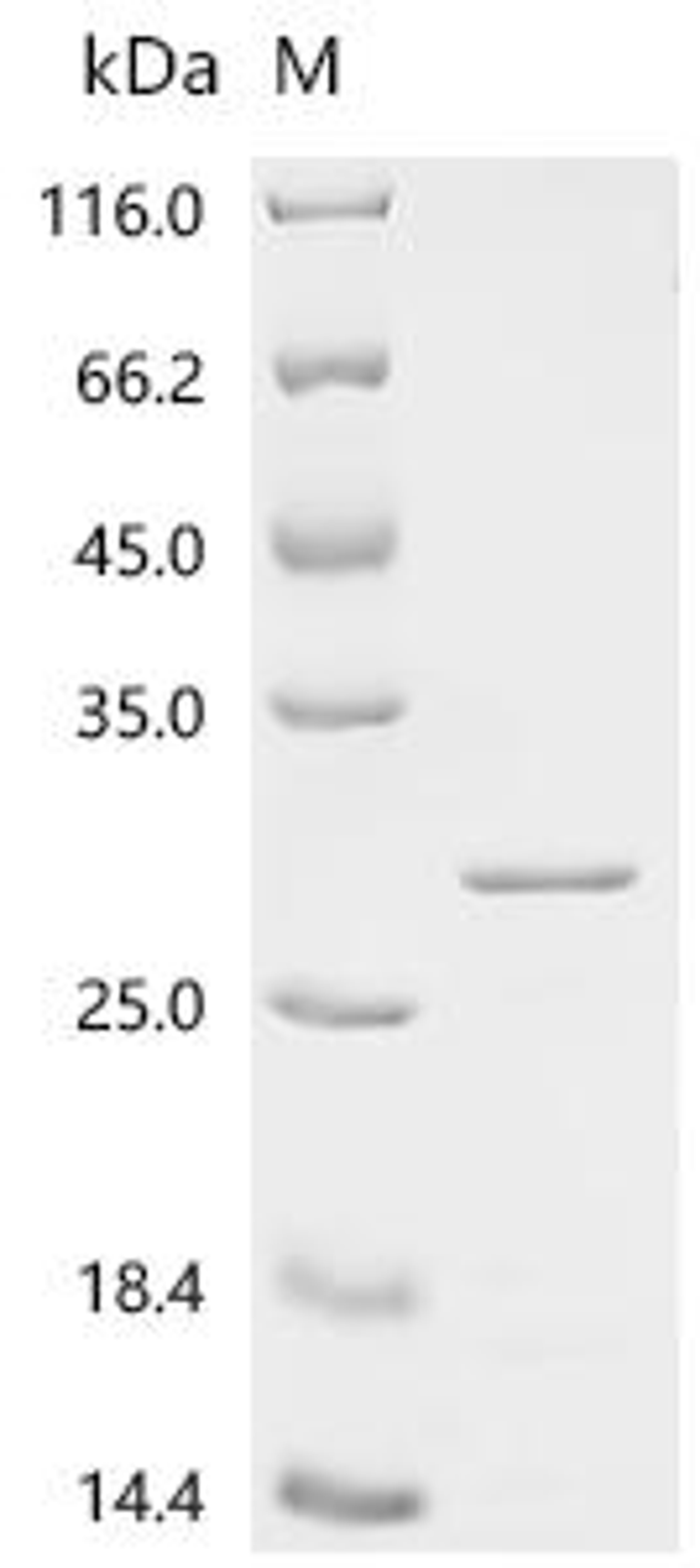(Tris-Glycine gel) Discontinuous SDS-PAGE (reduced) with 5% enrichment gel and 15% separation gel.