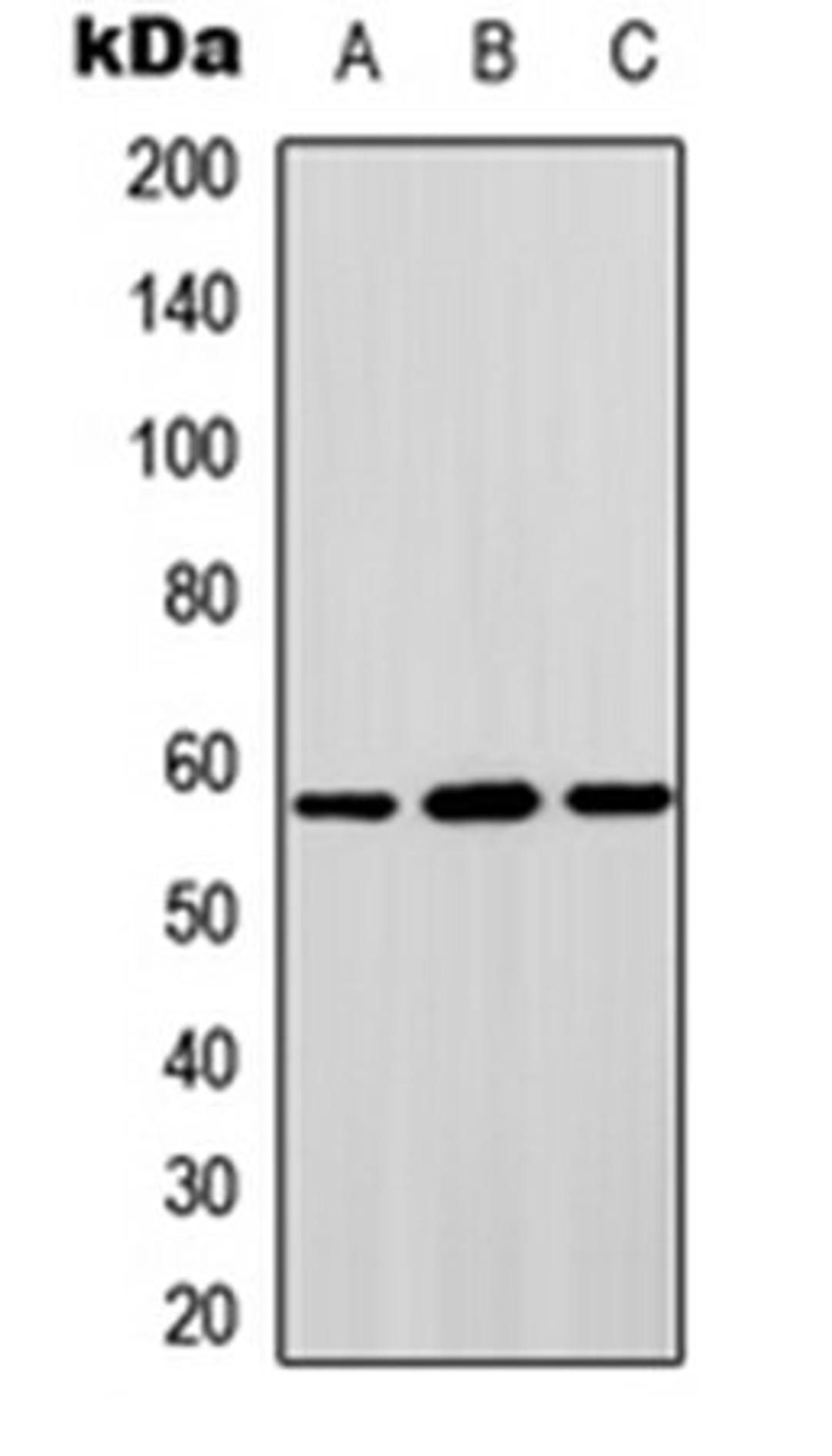 Western blot analysis of HepG2 (Lane 1), Hela (Lane 2), NIH3T3 (Lane 3) whole cell lysates using STAM2 antibody