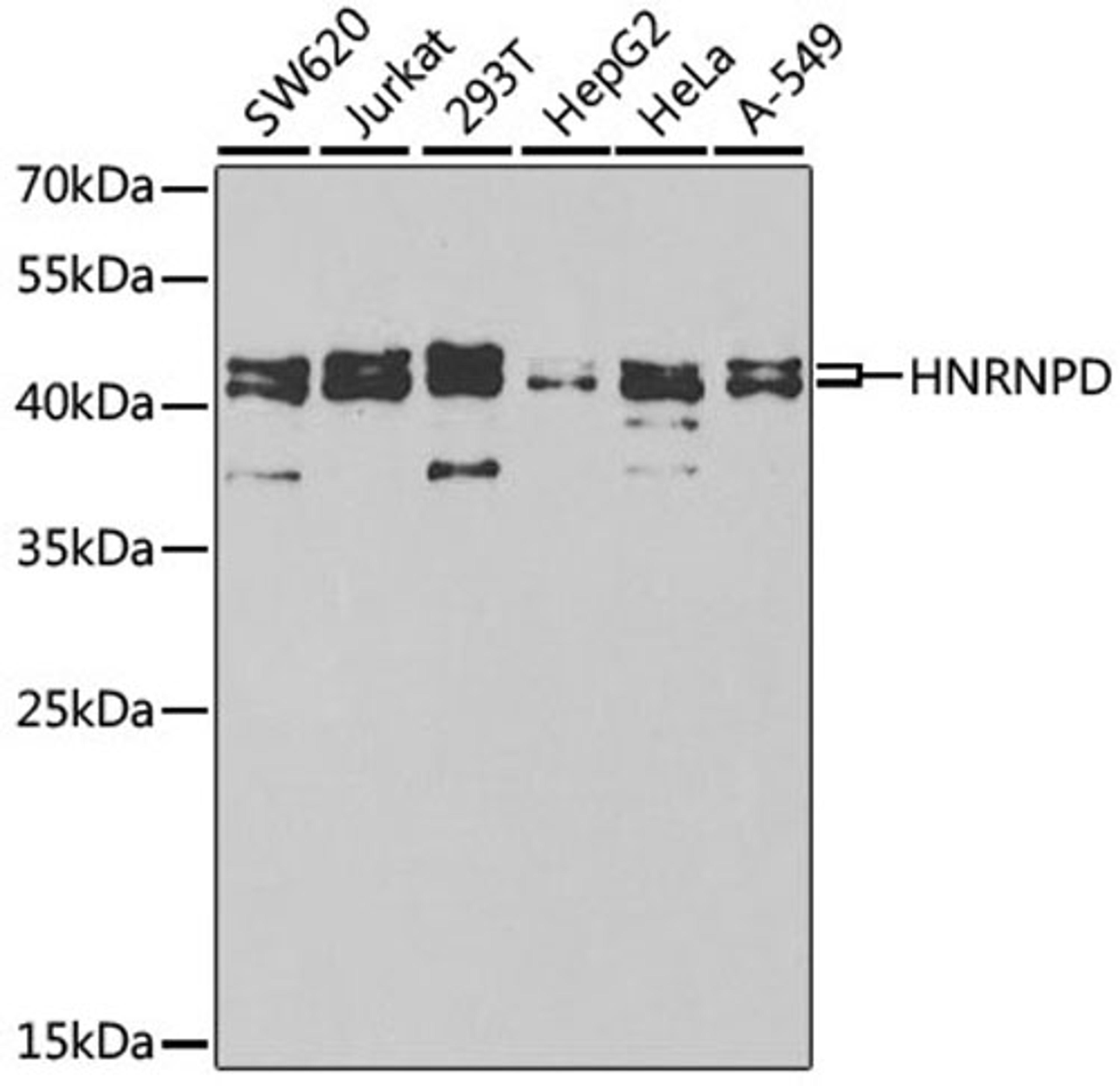 Western blot - HNRNPD antibody (A1828)