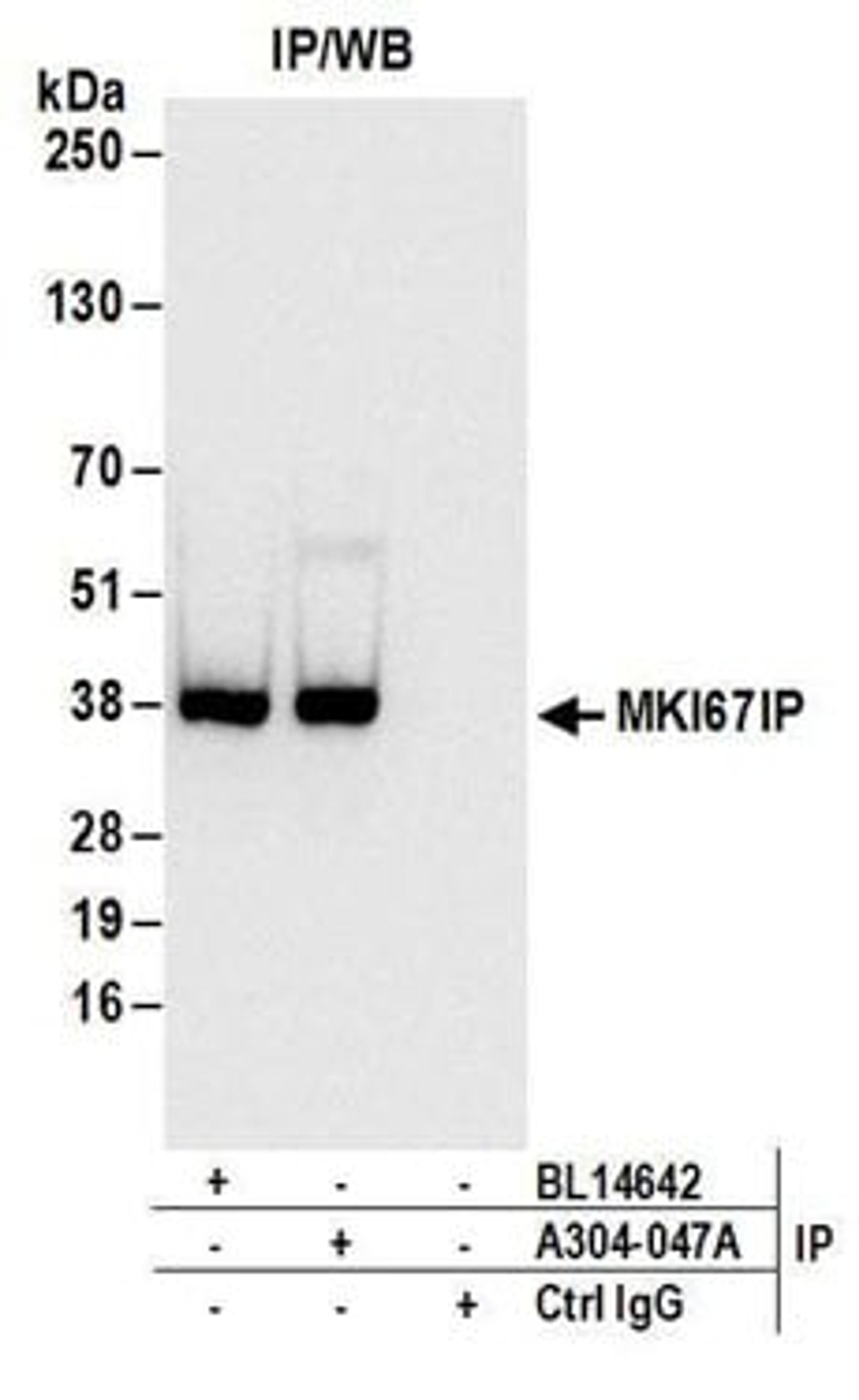 Detection of human MKI67IP by western blot of immunoprecipitates.