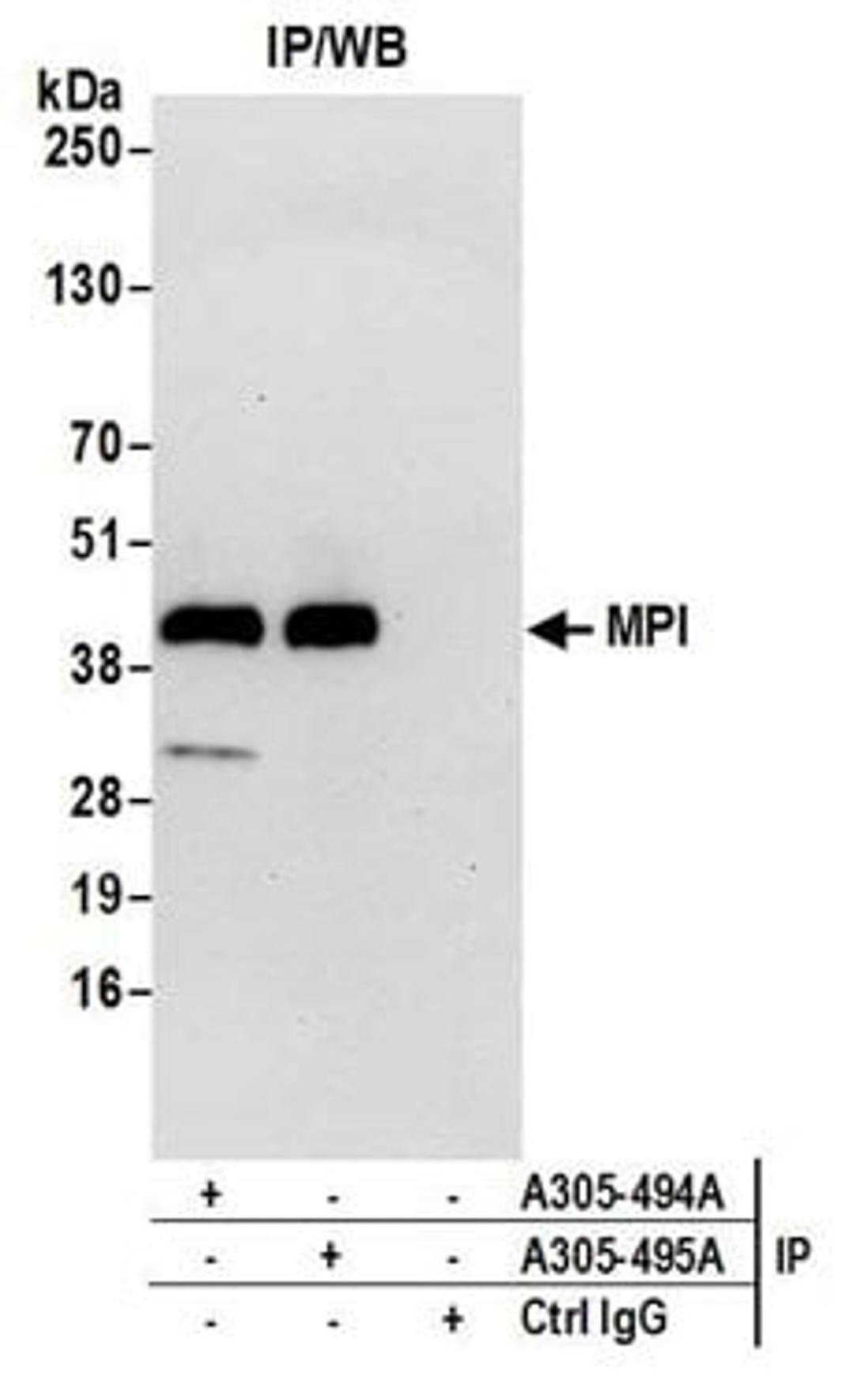 Detection of human MPI by western blot of immunoprecipitates.