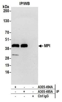 Detection of human MPI by western blot of immunoprecipitates.