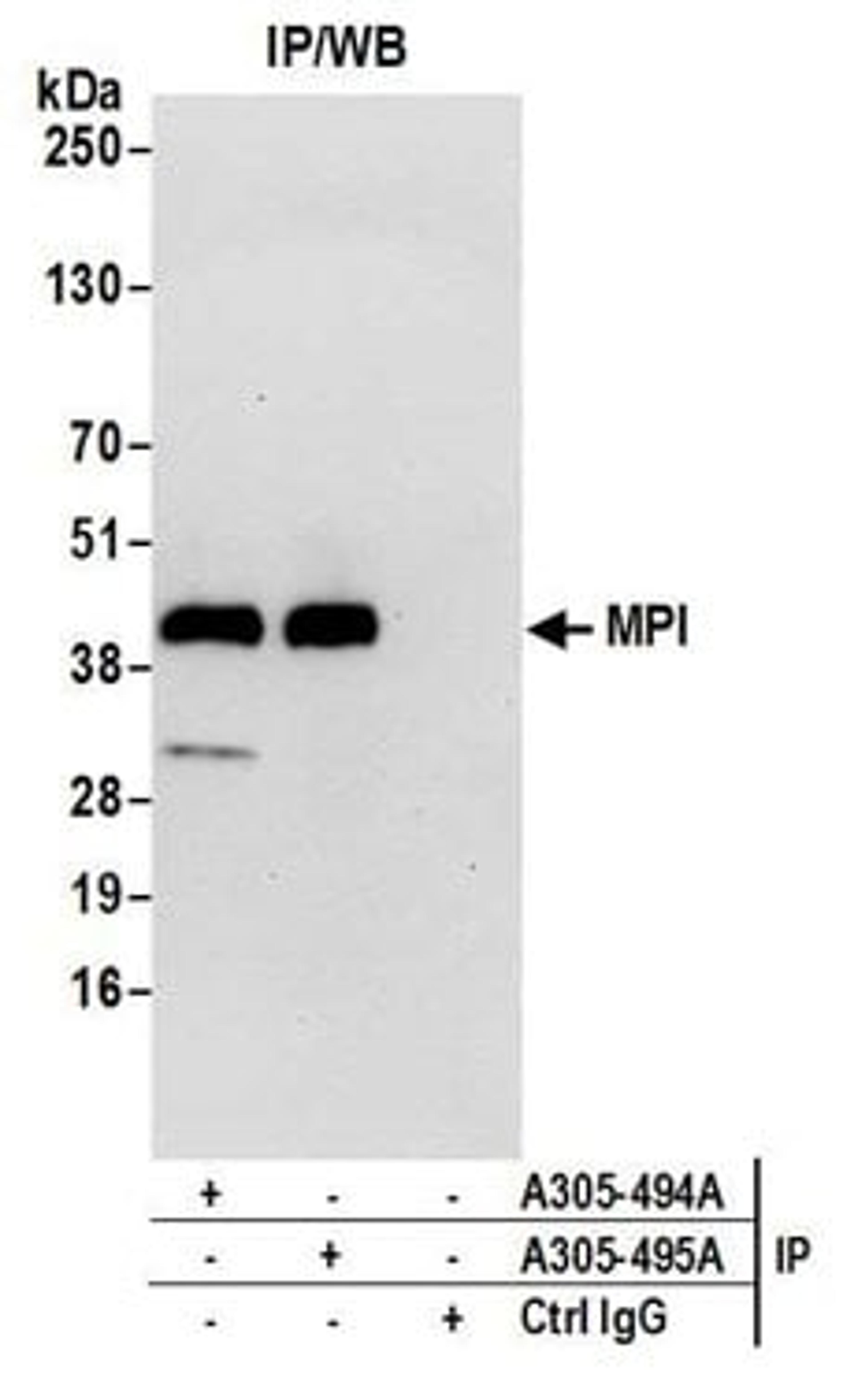 Detection of human MPI by western blot of immunoprecipitates.